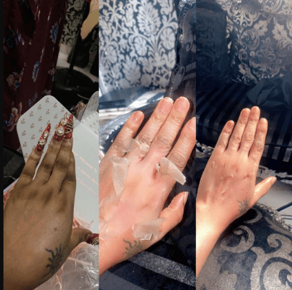 “Micheal Jackson no do pass this one …cancer is that you?”” – Netizens r!dicule Bobrisky after he revealed his new ‘skin peeling’ process